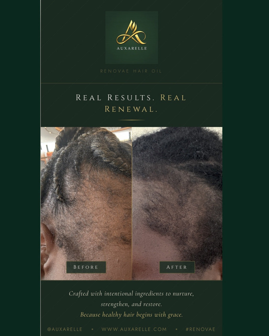 Renovae | Restorative Hair & Scalp Oil